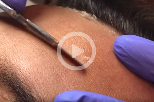 Beauty Insider | Beauty At Home: How To Try Dermaplaning At Home 