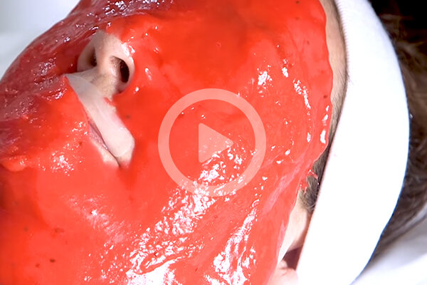 Beauty Insider: Vampire Facial
